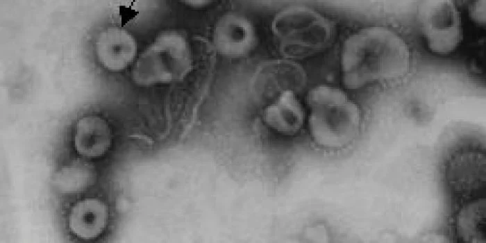 Virus Baru: Coronavirus dan Penyakit SARS