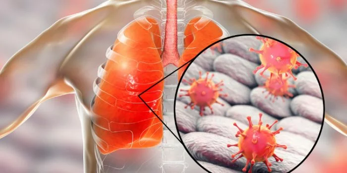 Virus Misterius Diduga Sebabkan Penyakit Paru-Paru