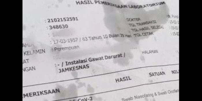 Viral Hasil Swab Positif Covid-19 Jadi Bungkus Gorengan