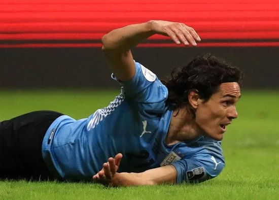 Kabar Buruk Bagi Manchester United, Edinson Cavani Cedera Betis